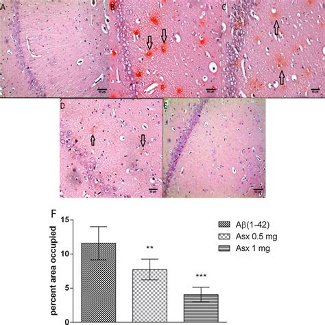 Histology of CA1 region of hippocampus stained with Congo red after 35 ... 
