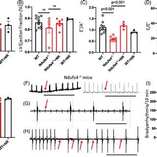 Diastolic Dysfunction And Bradyarrhythmia In Ndufs4 Deficient Mice Is