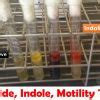 Sulfide Indole Motility Test Archives Universe84a