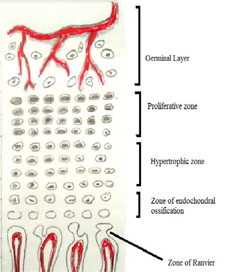 Growth Plate And Physeal Injuries