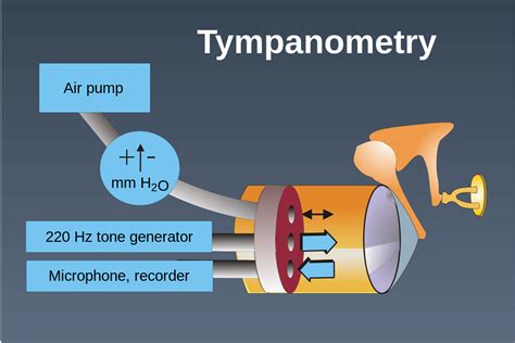 Tympanometry : A Middle Ear Test Procedure - Best Social Submission