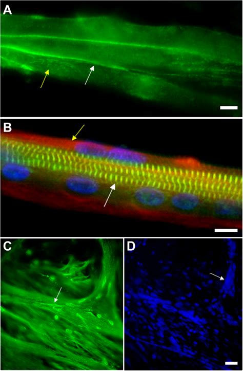 Myoblast Adhesion And Myotube Formation Are Hallmarks Of Skeletal