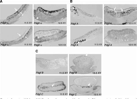 Figure 1 From Pdgfr Alpha Mediates Testis Cord Organization And Fetal