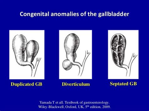 Ultrasound Of The Gallbladder