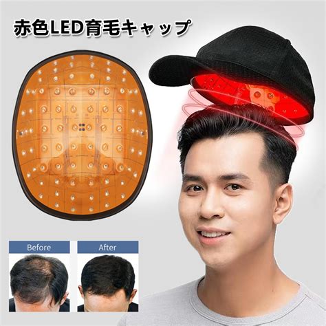 【楽天市場】【即納】育毛キャップ 育毛システム81個 赤色 Led 育毛 赤外線led 育毛デバイス 育毛 ヘルメット 薄毛・抜け毛対策 髪