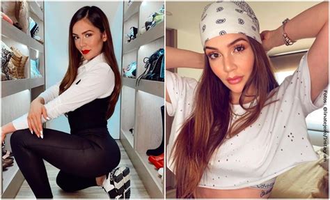 Lina Tejeiro se dio la vuelta y mostró sus cicatrices en bikini Vibra