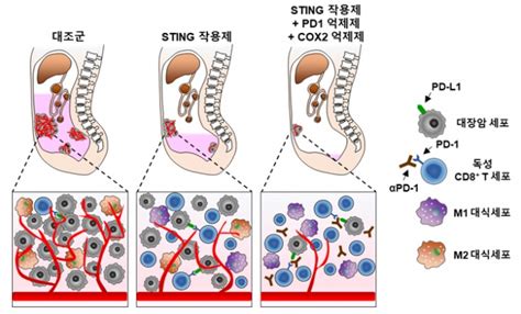 대장암 면역항암제 내성 극복 가능성 제시