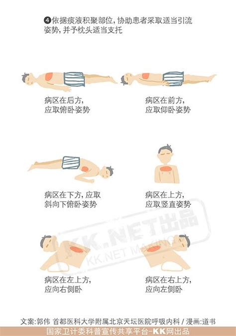 拍背排痰：比化痰藥還有效 每日頭條