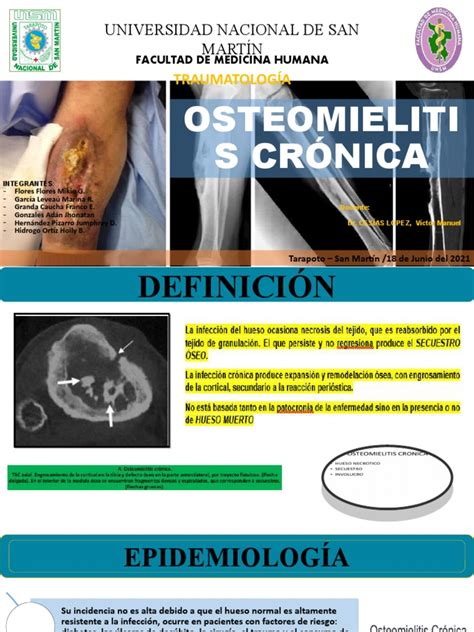 Osteomielitis Crónica Pdf Hueso Lesión