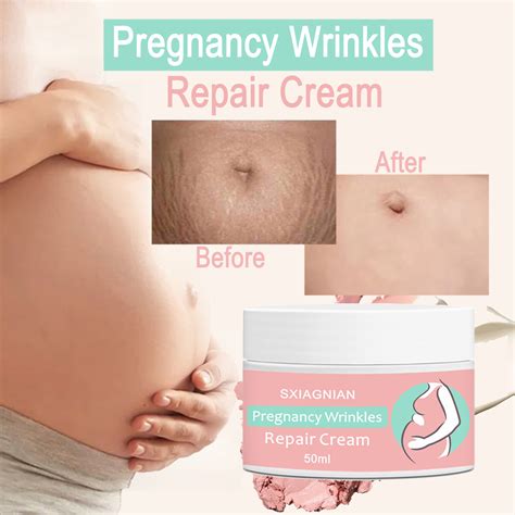 Natural Organic Stretch Mark Remove Cream For Pregnancy Repair Scar Marks China Stretch Marks