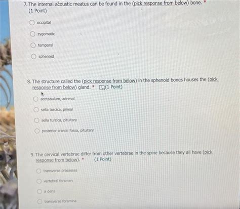 Solved 7. The internal acoustic meatus can be found in the | Chegg.com 