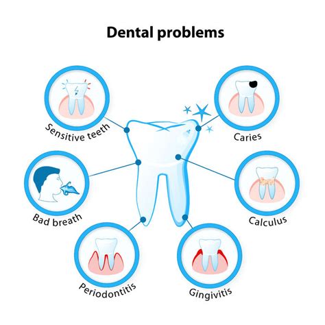 Link Between Diabetes And Oral Health Overland Park Dentistry