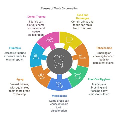 Tooth Discoloration Causes And Treatments