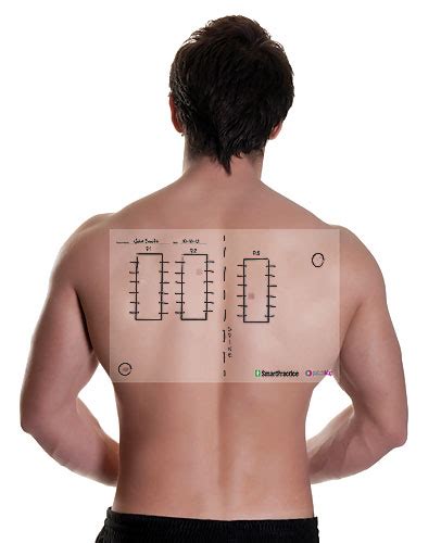 Patchmap Skin Patch Test Orientation Sheets Smartpractice Dermatology