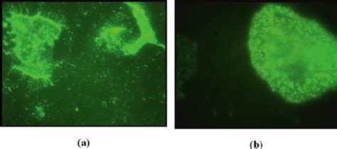 Fluorescence Microscopy Images With Magnification A And B Of