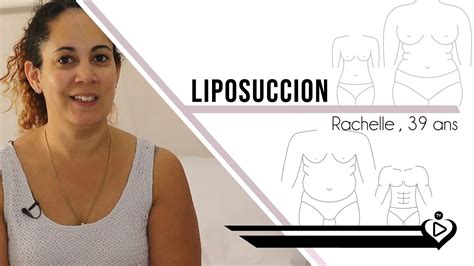 Liposuccion Et Augmentation Mammaire Pour Rachel Medespoir TV