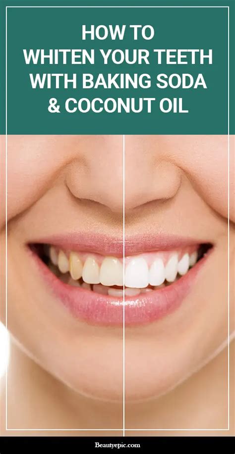 How To Whiten Your Teeth Using Coconut Oil And Baking Soda