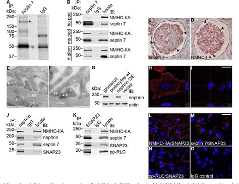 Figure 1 From Septin 7 Reduces Nonmuscle Myosin IIA Activity In The