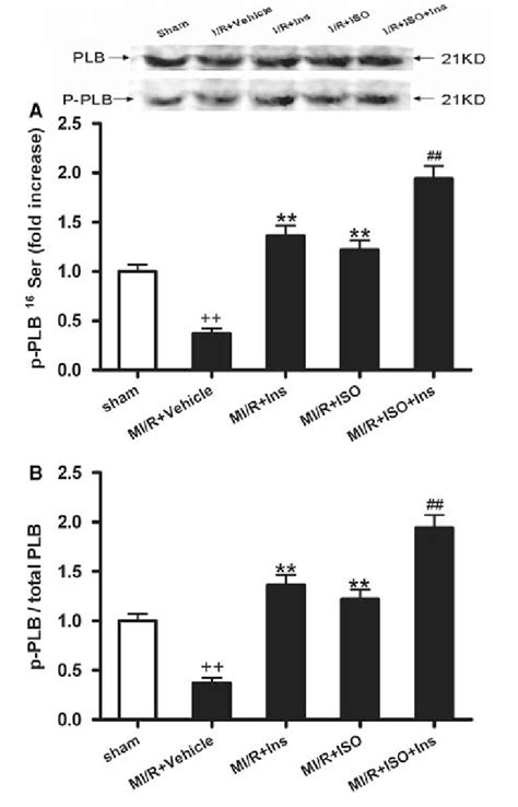 Protein Kinase A Pka Dependent Phosphorylation Of Phospholamban Plb