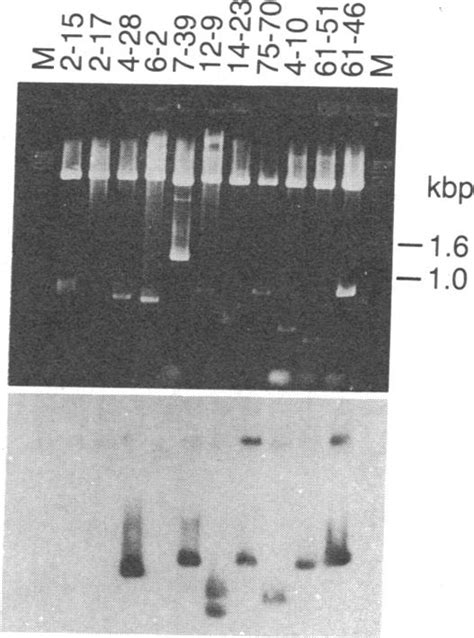 Dot Blot Analysis Of Schistosome Worm Rna A Ss Cdna Obtained By