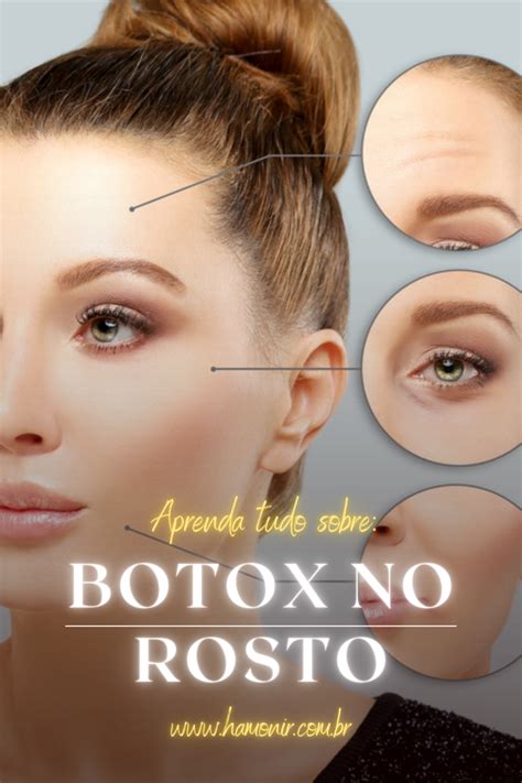 O botox no rosto é um dos principais tipos de procedimento de estética