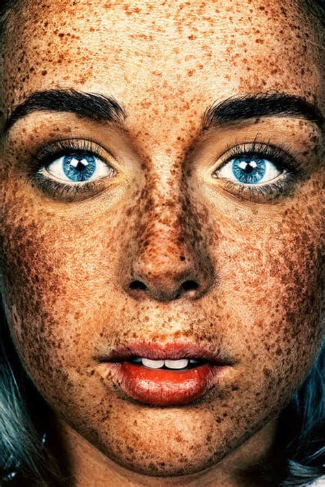 Amazing Portraits That Prove Freckles Are Beautiful