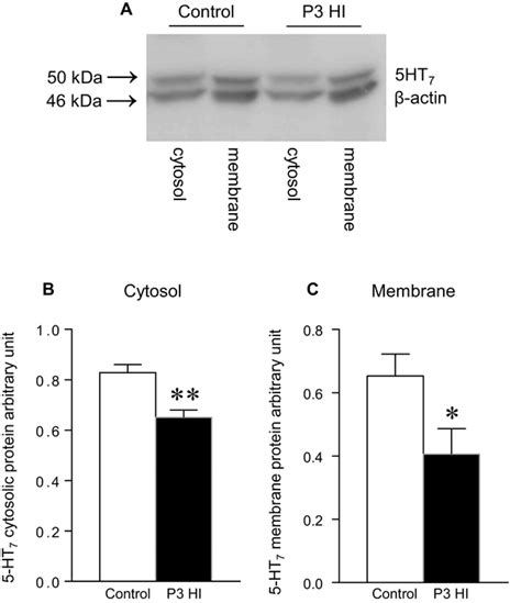 5 Ht7 Cytosolic And Membrane Protein Expression In The P3 Hi Rat Brain