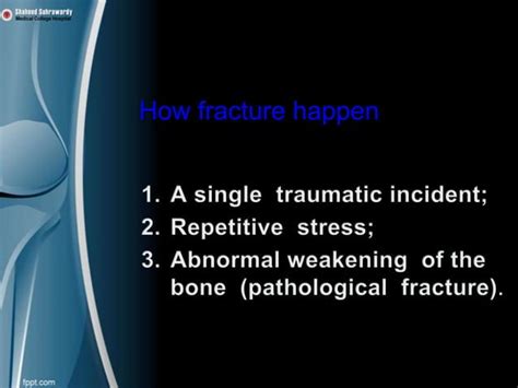 Fracture Management Basic Ppt