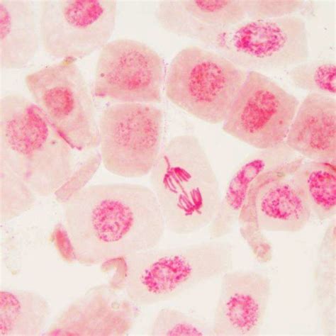 Laggard Chromosome In Metaphase Download Scientific Diagram