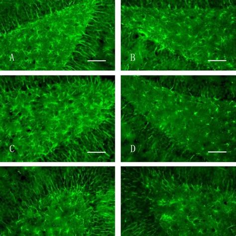 GFAP immunohistochemical staining of the hippocampus of rats (400×, Bar ... 