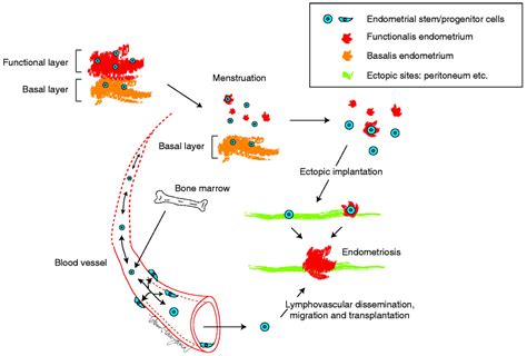 Jpm Free Full Text A Revised Stem Cell Theory For The Pathogenesis