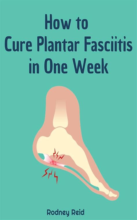 How To Cure Plantar Fasciitis In One Week Ebook Reid Rodney Amazonca Kindle Store