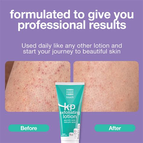 Buy Keratosis Pilaris Lotion Online Touch Skin Care