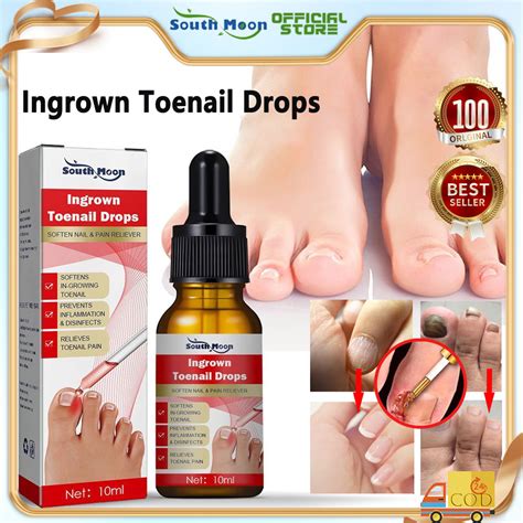 South Moon Ingrown Toenail Drops Nail Fungal Treatment Nail Repair Essence Effective Nail Care