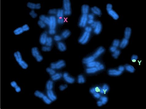 Metaphase Fish Analysis Showing Two Green Signals Of The Centromer Of