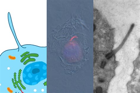 The primary cilium — Science Learning Hub 