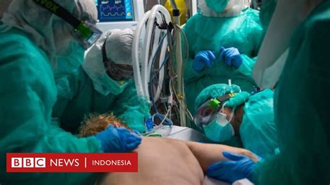 Pengobatan Pasien Corona Mengapa Menengkurapkan Pasien Covid 19 Bisa