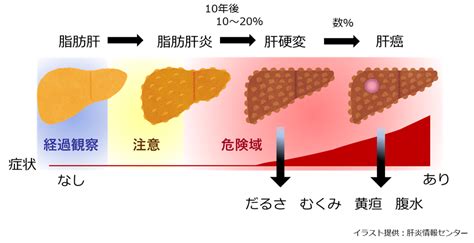 脂肪肝プロジェクト患者様へ 熊本大学大学院生命科学研究部 生体機能病態学分野消化器内科学講座