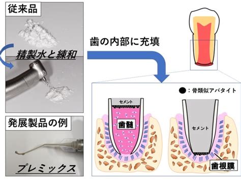 歯科用ケイ酸カルシウム系セメントの生体活性評価 新潟大学 社会連携推進機構