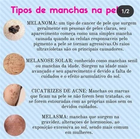 Tipos De Manchas De Pele