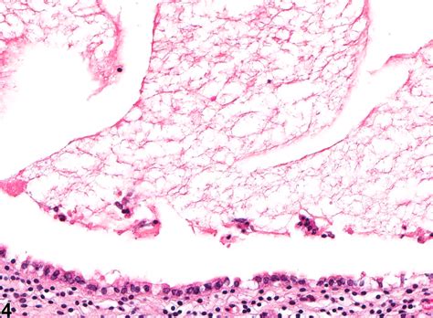 Uterus Dilation Nonneoplastic Lesion Atlas