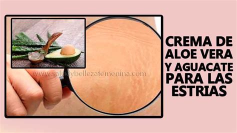 Crema de aloe vera y aguacate para las estrías Salud y belleza