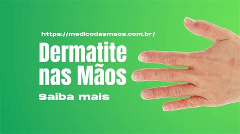 Dermatite Nas M Os Causas Sintomas Tratamento E Preven O