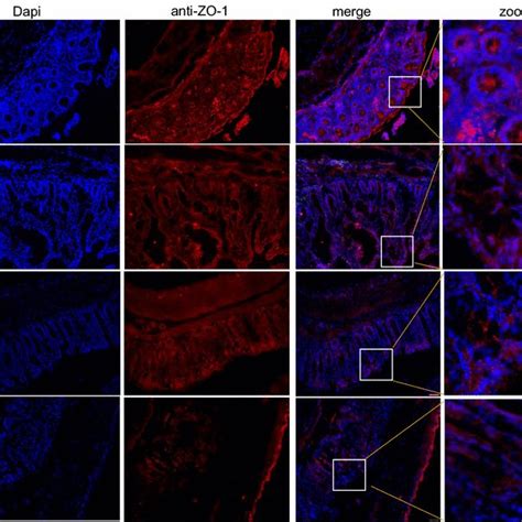 A Immuno Fluorescence Staining Of ZO 1 In The Chronic DSS Model Colon