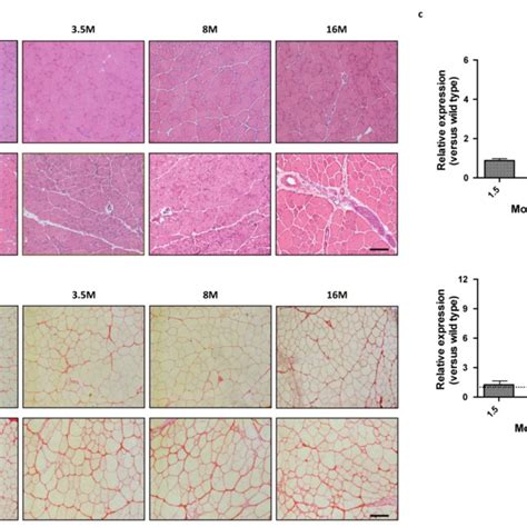 Cardiotoxin Induced Injury On Wild Type And Mdx Skeletal Muscle Tissue