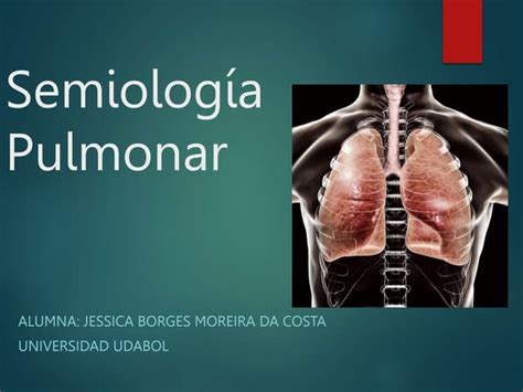 Semiología Pulmonar Síndromes Y Signos Ppt