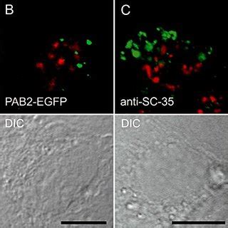 Baculovirus Pml Nbs Nuclear Speckles And Cbs In Hepg Cells A And B