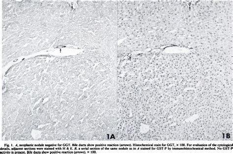 Figure From Analysis Of Peroxisome Proliferator Induced Preneoplastic