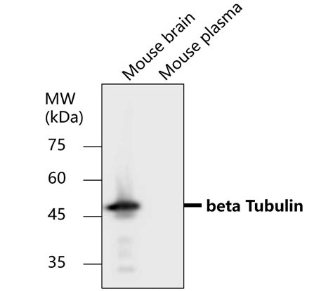 Beta Tubulin Antibody Ir Ireal Biotechnology Inc