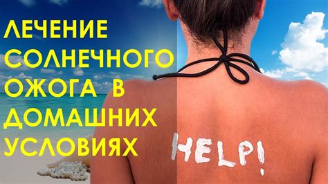 Лечение солнечного ожога в домашних условиях. Что делать при солнечном ...